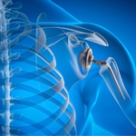 Shoulder Joint Replacement in Encino: Restore Mobility and Live Pain-Free